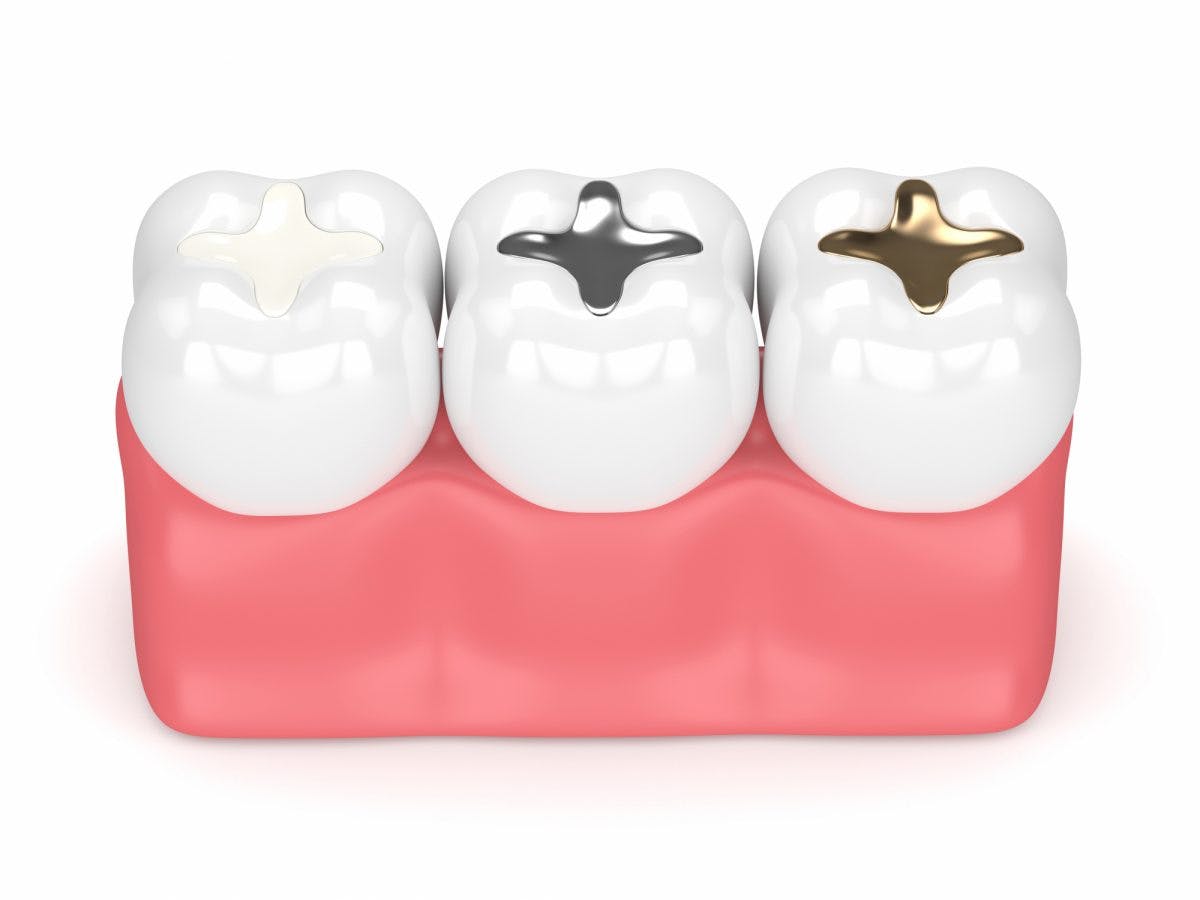 Dental Filling Materials