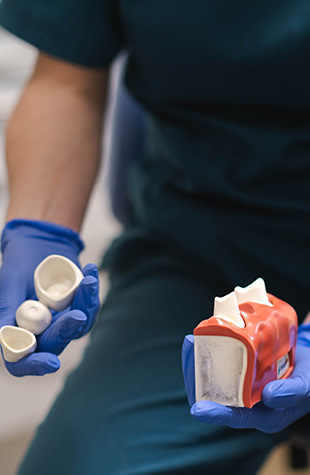dental bridges in ashburton